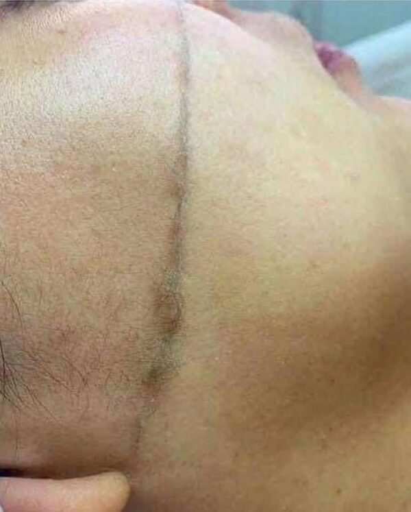 شفرات ترينا للوجه