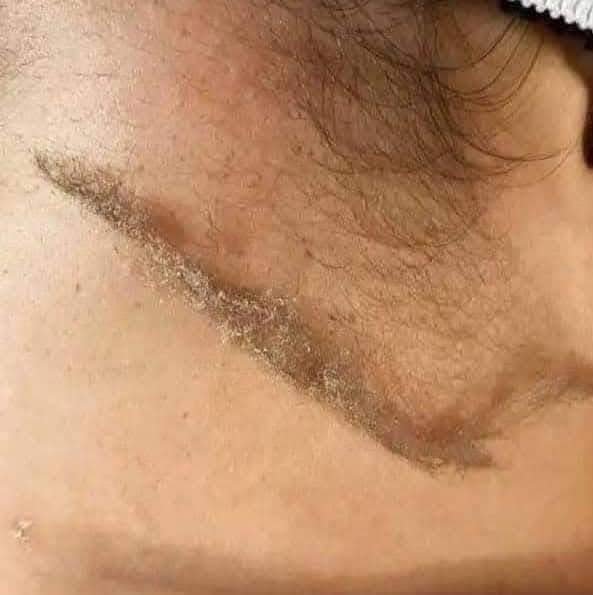 شفرات ترينا للوجه